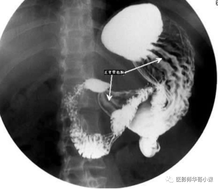 狗狗钡餐造影费用详解